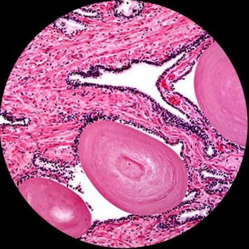 40X-1000X LED Cordless All-Metal Compound Microscope I483